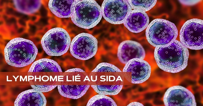 Lymphome lié au SIDA