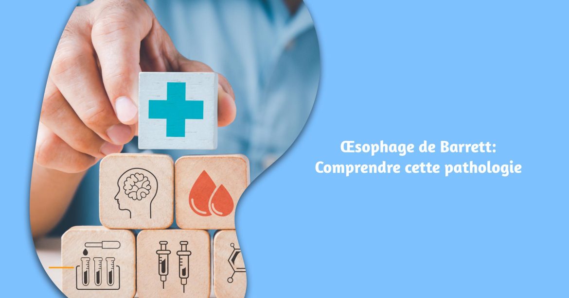 Œsophage de Barrett: Comprendre cette pathologie